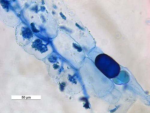 Mykorrhiza in der Wurzel (arbuskuläre Mykorrhiza)